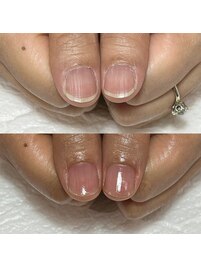 ジェル等を使わない自爪育成ケア