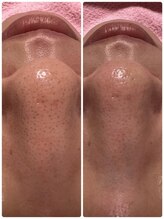 ケイココ(Keicoco)/