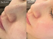 テオリア(TEORIA)/