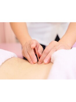 鍼灸施術を受けたい