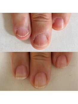 自爪育成コース卒業しました♪