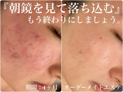 アリィ(Alii hisaya)の写真