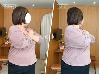 リリーフポート フェミナ鍼灸整体院 大濠公園店/お悩み：腰痛・疲労感