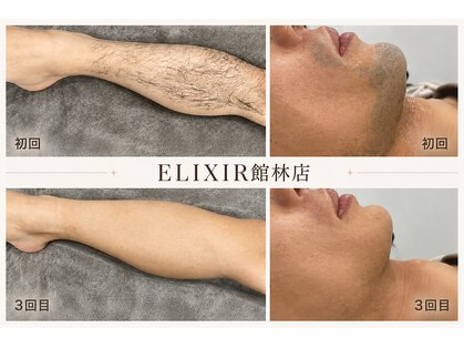 脱毛専門サロン エリクサー(Elixir)の写真