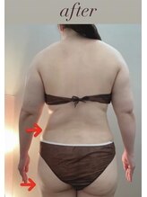 ブリス エナジーアンドサロン 福岡薬院店(bliss energy&salon)/エナジー（マシーン）　after