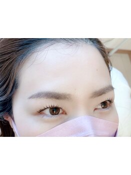 顔脱毛がしたい