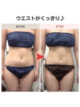 ビーフィール 池袋店(be feel)/ウエストラインもスッキリ！