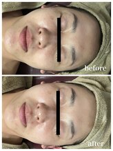 ジャスミン(Jasmin)/バリア機能改善ケア