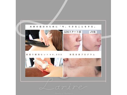 ラリール(Larire)の写真