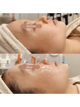 ベルチェリカ(Belle CHERIKA)/ララピールでツヤ肌爆誕！