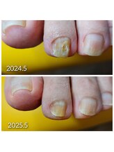 爪切り屋 足楽/