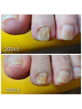 爪切り屋 足楽/