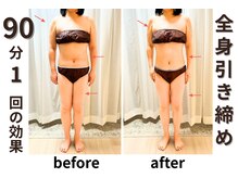 ゼロン(zelon)/引き締め