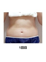 ヨサパーク テマ 牛込柳町店(YOSA PARK tema)/痩身/よもぎ蒸し/小顔/リンパ