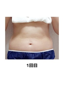 ヨサパーク テマ 牛込柳町店(YOSA PARK tema)/痩身/よもぎ蒸し/小顔/リンパ