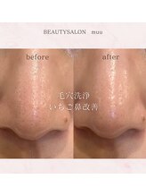 ムゥ(muu)/【毛穴洗浄】