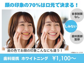 ホワイトニングカフェ 盛岡大通店(WhiteningCafe)