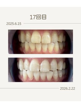 ホワイトニングショップ 福岡姪浜店/