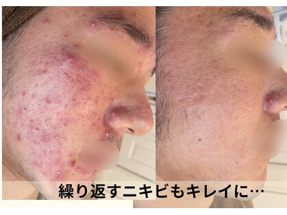 ポアレ(POARE)の写真
