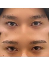 ハク 谷町(HAK.)/メンズ眉毛ワックスBefore/After