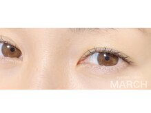 マーチ(MARCH)/ナチュラルマツエク