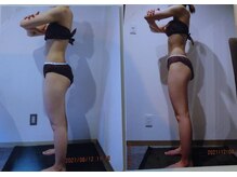 クイーン 札幌駅前店(Queen)/お客様　ビフォーアフター（17）