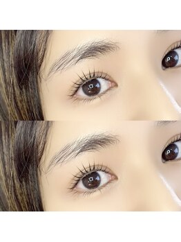 プラセル(placer)/