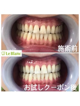 ルブラン 奈良店(Le Blanc)/他店で効果を実感出来なかった