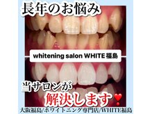 ホワイトニングサロン ホワイト(WHITE)/セルフホワイトニング/大阪/福島