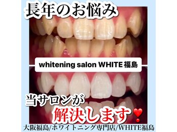 ホワイトニングサロン ホワイト(WHITE)/セルフホワイトニング/大阪/福島