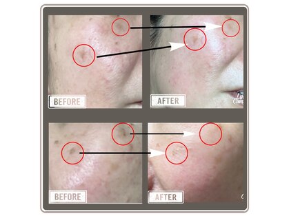 サロン ミー(salon Mee)の写真