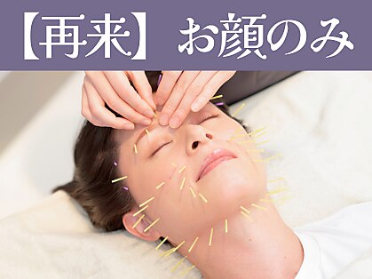 【都度ご利用の方】顔をシュッとリフトアップ美容鍼45分 \8,000（1回分）