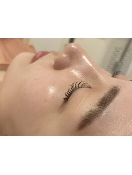 顔脱毛がしたい