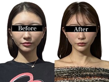 オアシス トウキョウ 心斎橋(OASIS TOKYO)/