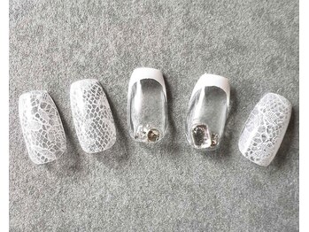 レースのガーリーセット