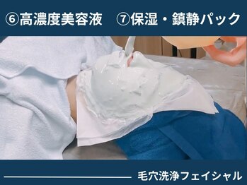 アポロ(Apollo)/【フェイシャル】【メンズ毛穴】