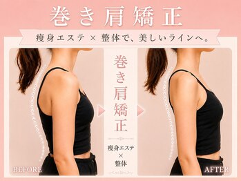エモーション 横浜関内店(Emotion)の写真/【デコルテ×背中×二の腕集中！華奢見えコース】筋膜マッサージ・肩甲骨はがしで薄着の準備に早めのケア
