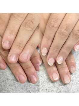 プライズアイリス アイラッシュ 池袋東口店(prize Iris eyelash)/深爪改善