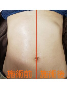 ルルアス(LUluas)/