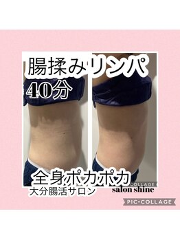 サロンシャイン(Salon Shine)/ウエストスッキリ！むくみとり