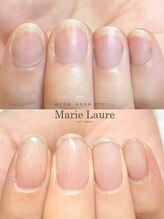 マリーロール 淀屋橋本店(Marie Laure)/自爪育成/深爪矯正/ネイルケア