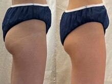 ヨサパーク リワード 本八幡駅前店(YOSA PARK Reward)/