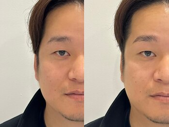 クラッシーブロウ 浦添/HBL[エイチビーエル]