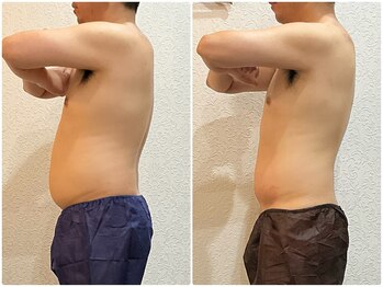 ウェリナ平和堂長久手院/小顔矯正/骨盤矯正/美脚サロン