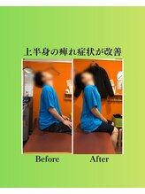 コア カイロプラクティック 錦糸町/ビフォーアフター　錦糸町/亀戸