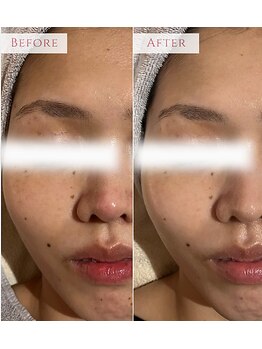 アンドニューリー(&NEWLY)/LDM水玉リフティング