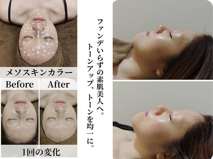 吉川美南ライフ整骨院の写真