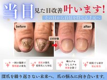 ブルームーンネイルズ(BLOOMOON.nails)