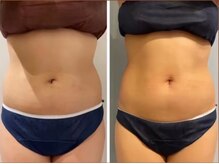 ルナグランデ(Luna grande.)/横幅をスッキリ！