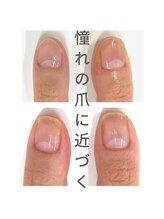 ブリエネイル/最強ネイルケア